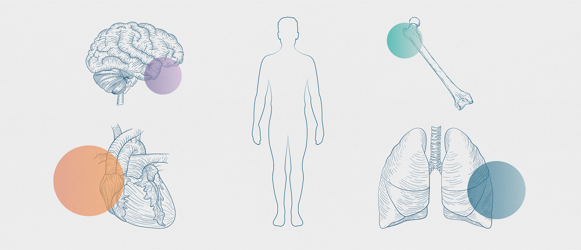 Silhouette of human body surrounded by percentages representing the prevalence of comorbid conditions among chronic migraine patients.10,11    
